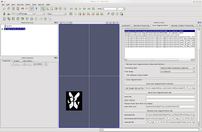 CA Works 3d view auto-segmentation result