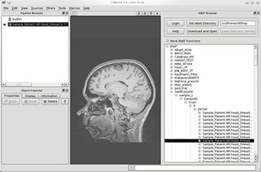XNAT CAWorks screenshot