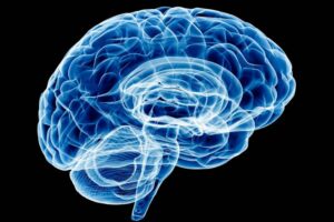 brain xray