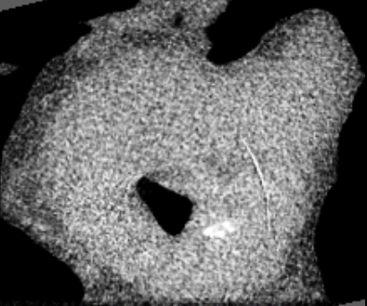 CT-Image