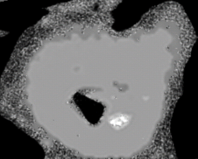 Segmented-Image