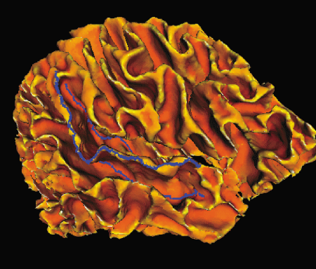 Maximal and minimal cortical curvature.